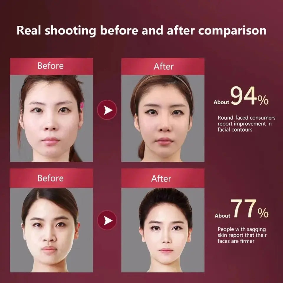 LED Photon Therapy Facial Slimming Vibration