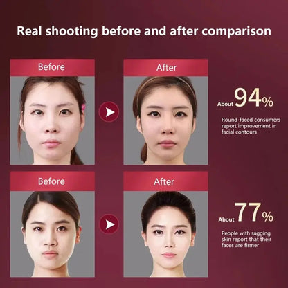 LED Photon Therapy Facial Slimming Vibration
